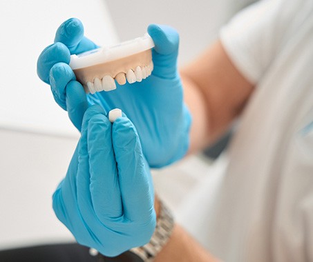 A dentist putting a dental crown on a model
