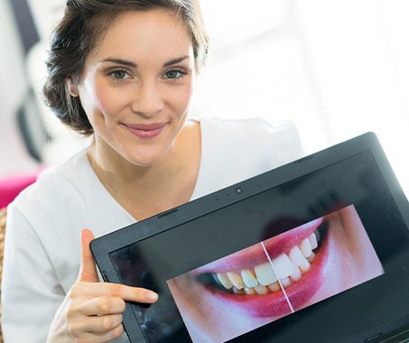 Woman pointing to picture of before/after dental treatment results