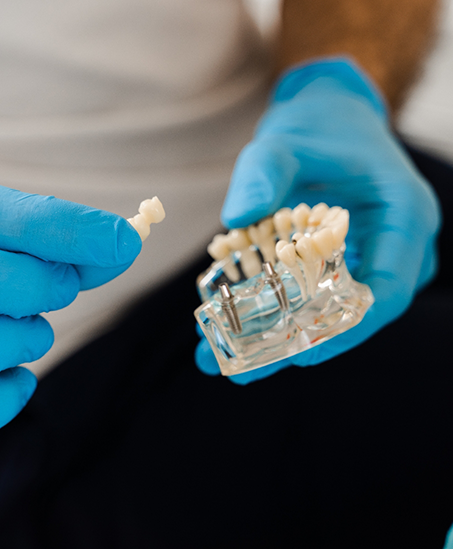 Dentist holding a model of an implant denture
