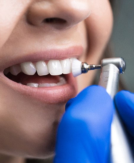 Nose-to-chin view of woman smiling as hygienist polishes her teeth