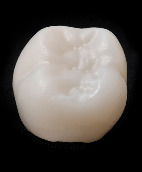 White dental crown against a black background