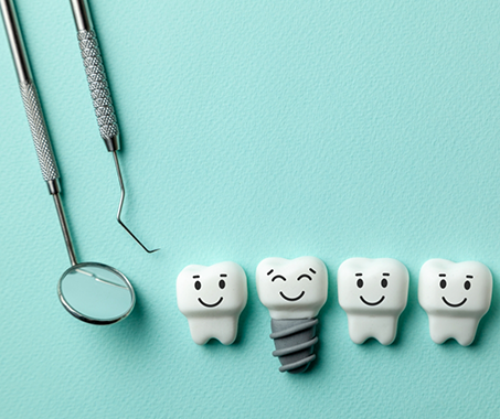 Illustration of a smiling dental implant among natural teeth