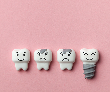 Illustration of a smiling dental implant next to two frowning damaged teeth