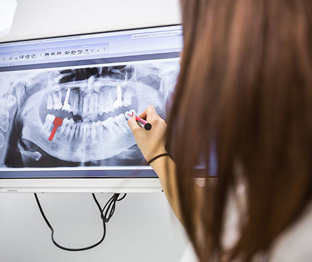 Dentist showing a patient an x ray of their teeth