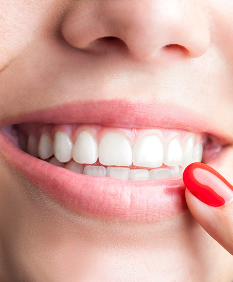 Close up of a person with flawless teeth pointing to their smile