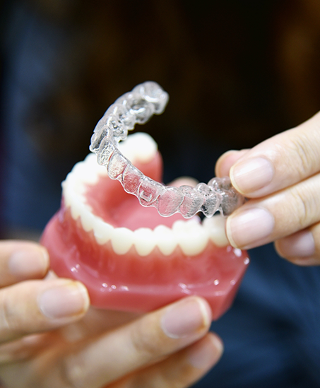 Dentist placing an Invisalign clear aligner over a model of the teeth