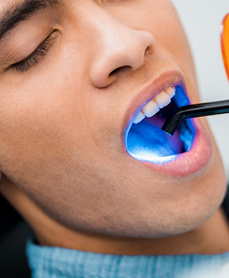 Dental patient receiving cosmetic bonding on a tooth
