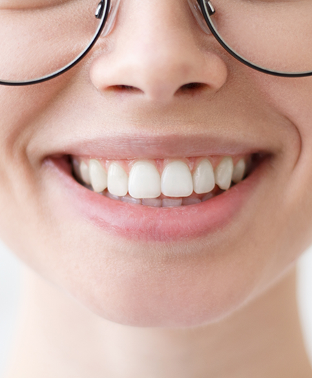 Close up of a person smiling with flawless teeth