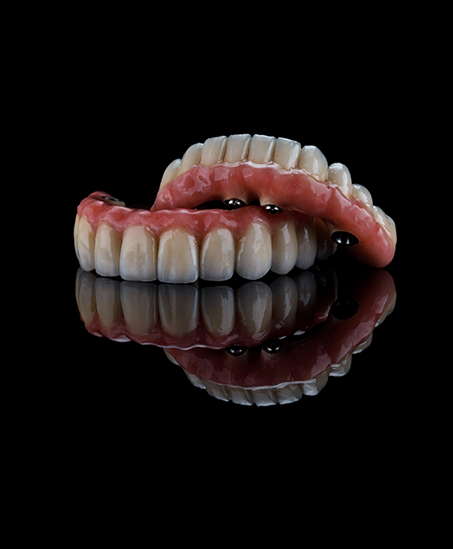 Set of implant dentures against a black background