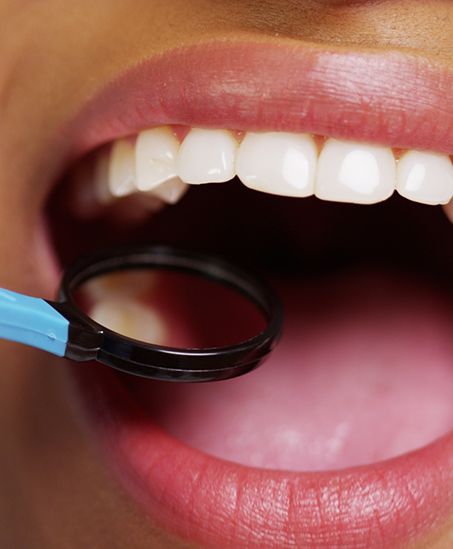 Close up of a dental mirror outside of a mouth with white teeth