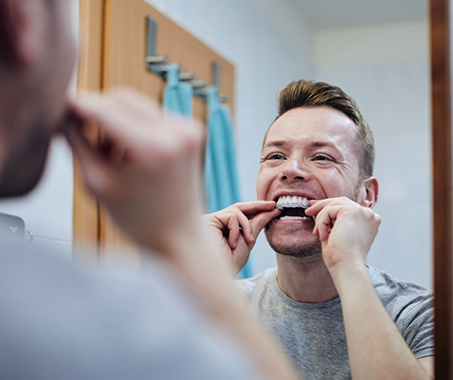 Man at home placing a whitening tray over his teeth