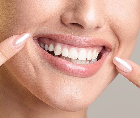 Smiling woman pointing to her white teeth